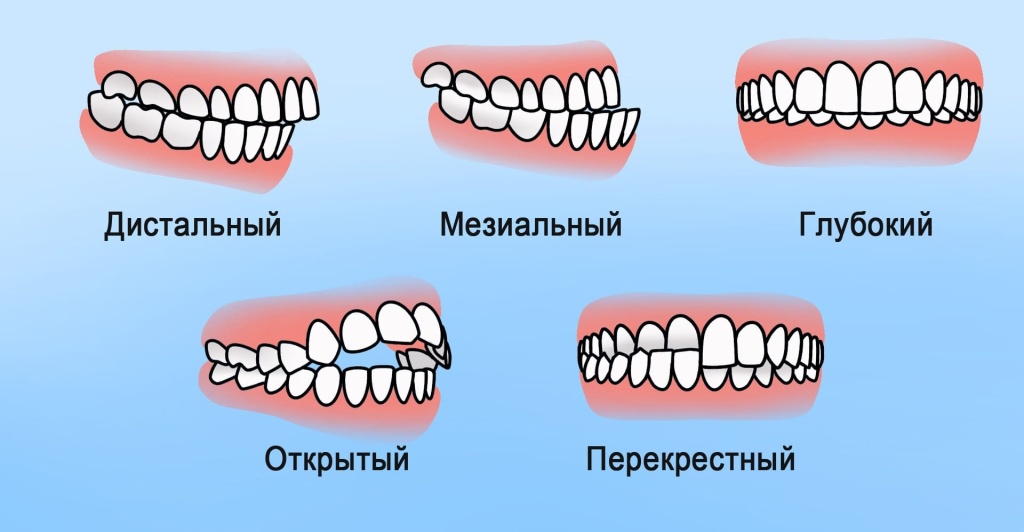 Картинка поста