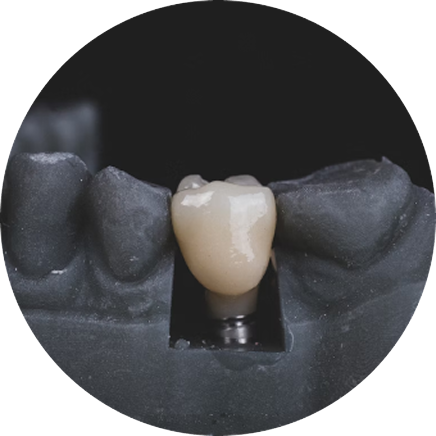 Какой имплантат выбрать
