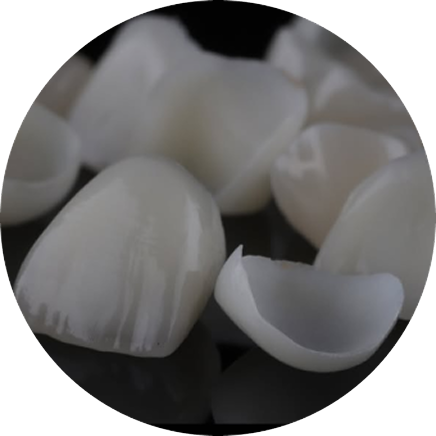 Развеем мифы про виниры
